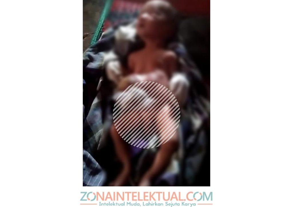 Srg Penderita Tumor di Paluta
