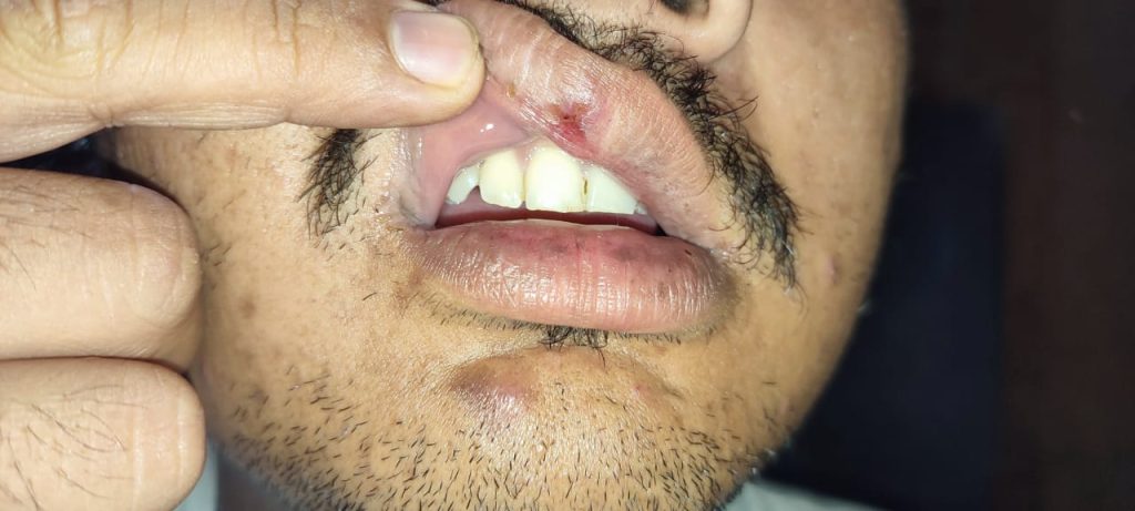 diduga penganiayaan diduga penganiayaan